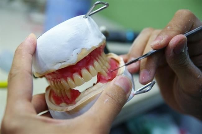 Protetične izdelke je potrebno načrtovati in izdelovati na zobnih in obzobnih tkivih, ki so zdrava. (foto: FreeDigitalPhotos.net)