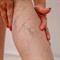 Premagajte težave z ožiljem s kompresijskimi nogavicami OFA 365
