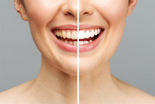 	Zobje bodo bolj beli in čisti, če jih čistite s pecilnim praškom. (foto: Freepik.com)