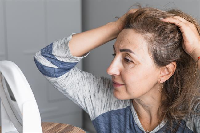Prhljaj na enem delu lasišča lahko razkrije več o stanju kože, kot si mislimo. (Foto: Freepik)