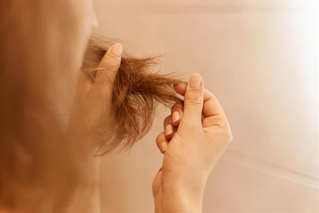 Izpadanje las lahko ženske vznemiri še bolj, kot moške. (Foto: Freepik.com)