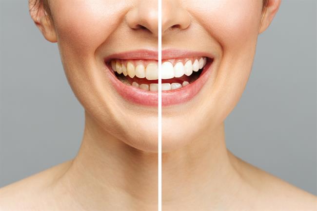 Zobe bi morali ščetkati pet do deset minut na dan. (foto: Freepik.com)