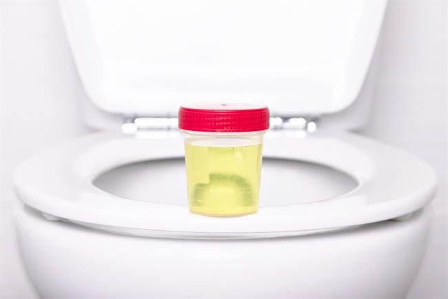 Barva urina sporoča, kako zdravi ste. (foto: Freepik.com)
