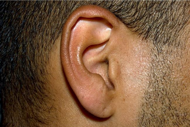 Ušesno maslo ščiti uho. (foto: www.sxc.hu)