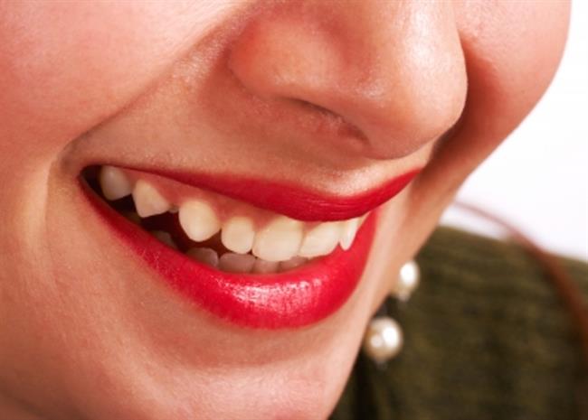 Vaši zobje so lahko bolj beli v nekaj trenutkih. (foto: FreeDigitalPhotos.net)