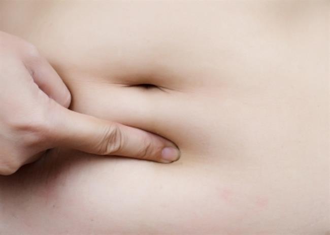 Maščobne obloge okrog trebuha niso zdrave. (foto: freeDigitalPhotos.net)