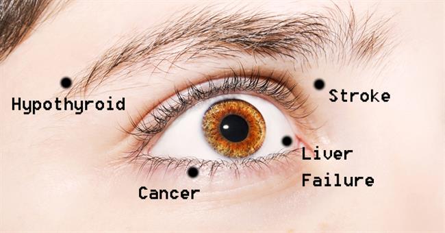 Naše oči lahko razkrivajo, kako zdravi smo. (foto: davidwolfe.com)