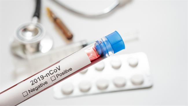So odkrili zdravilo, ki bo pozdravilo osebe, okužene s koronavirusom? (foto: freepik.com)