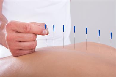 Akupunktura - kako vam lahko pomaga?