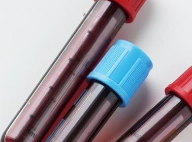 Vaša krvna skupina razkriva, katere bolezni vam grozijo